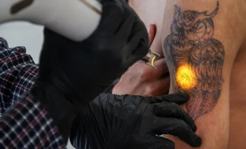 Tatouages : la fin de la cartouche fashion ?